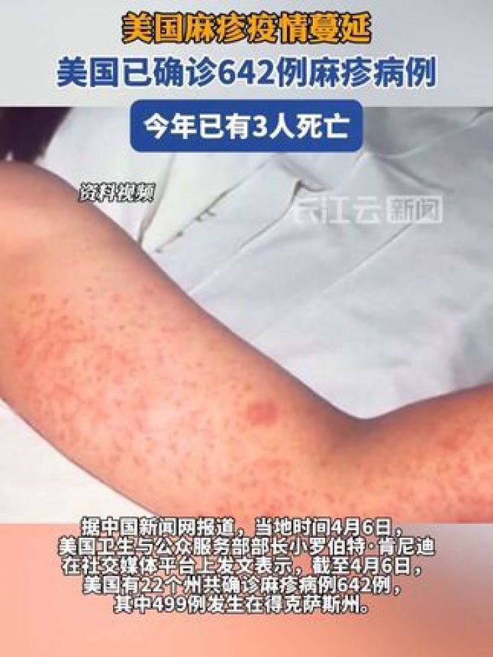  疫情病毒是美国人放的吗(疫情是美国人制造的吗视频)
