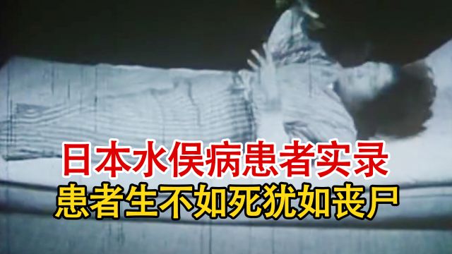 实录1956年,日本水俣病患者发病时影像,四肢抽搐举动怪异如丧尸