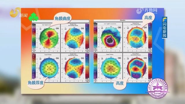 视力短时间内急剧下降,看东西模糊,建议及时去正规医院进行检查