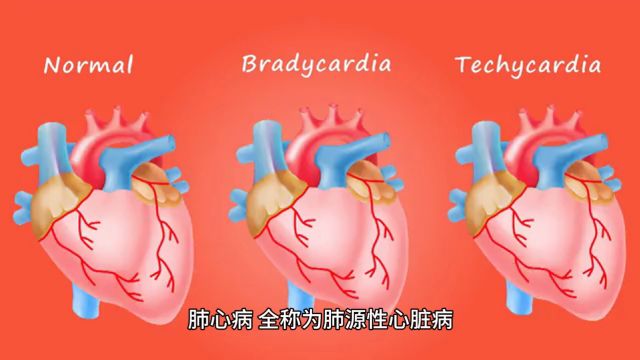 肺心病的主要症状郭来