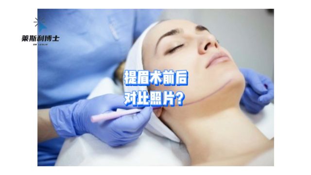 切眉1一7天的图片来袭~提眉术前后对比照片?