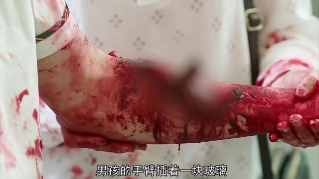 男孩手臂上插着一块玻璃,他却淡定的将玻璃直接拔出