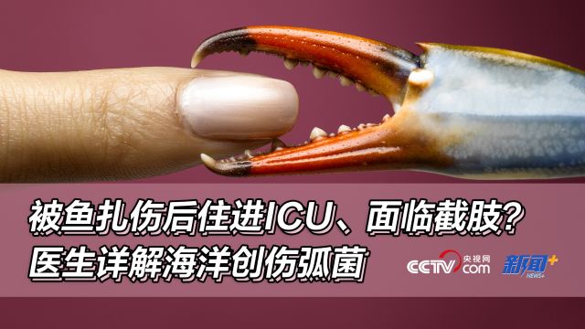 被鱼扎伤后住进ICU、面临截肢?医生详解海洋创伤弧菌