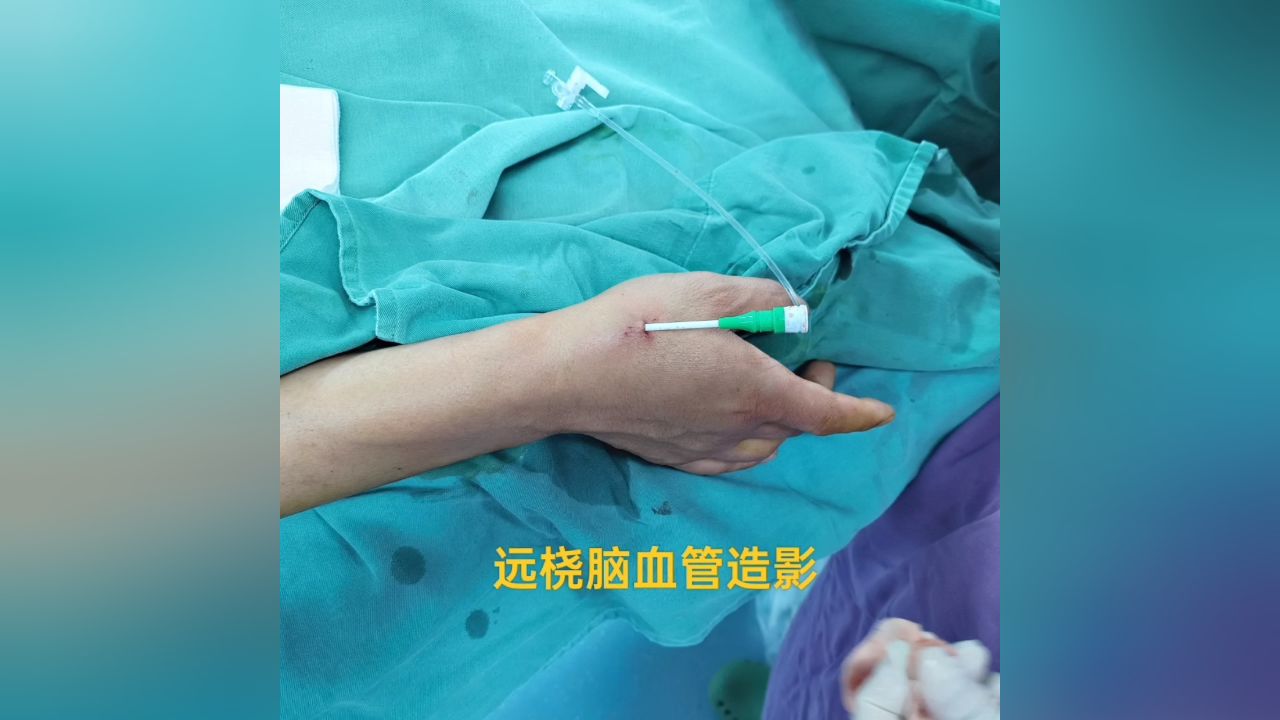 6.1远桡脑血管造影.